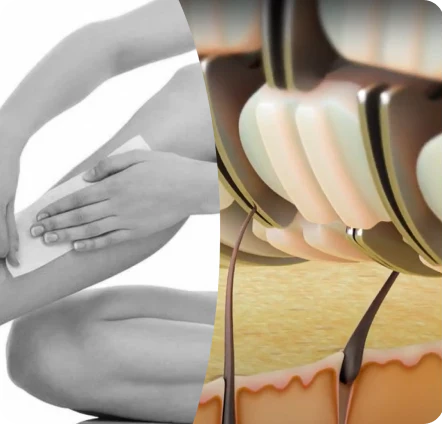 Épilateur | ÉpilSmooth