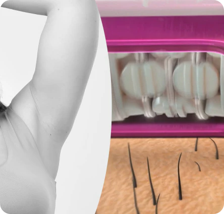 Épilateur | ÉpilSmooth